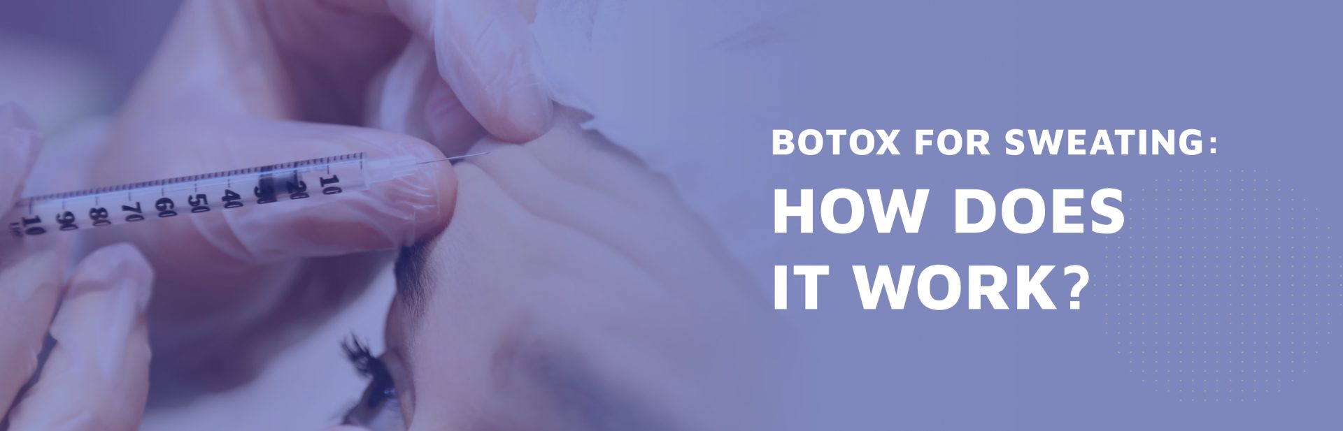 Botox For Sweating: How Does It Work? - Zcosmetic Health