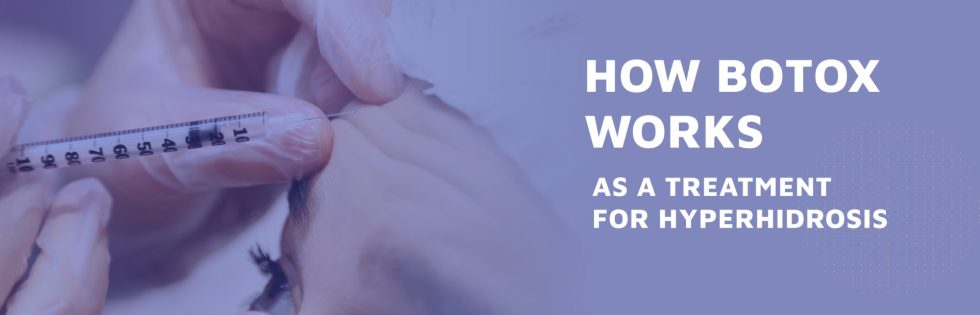 How Botox Works As A Treatment For Hyperhidrosis 