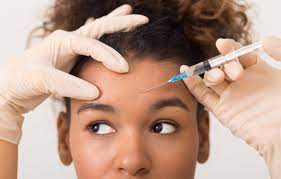 Botox injection administered on woman's forehead for wrinkle reduction A close-up stock photo of a healthcare professional administering a Botox injection to a woman's forehead, highlighting a common area for wrinkle treatment