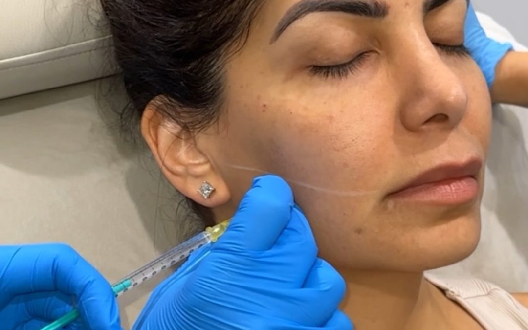 Doctor administering masseter Botox to a patient in a clinic setting.